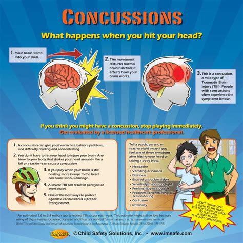 Concussion Prevention Tips